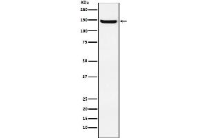 Western blot analysis of JAG2 expression in HUVEC cell lysate.