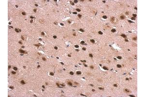 Immunohistochemistry (IHC) image for anti-DEAD (Asp-Glu-Ala-Asp) Box Polypeptide 1 (DDX1) (Internal Region) antibody (ABIN2856062)