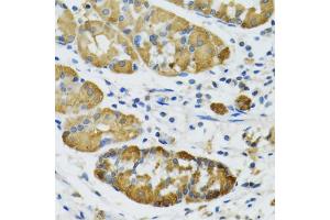 Immunohistochemistry of paraffin-embedded human stomach using PLA2G2D antibody (ABIN5974036) at dilution of 1/100 (40x lens). (PLA2G2D Antikörper)