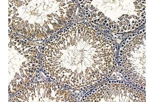 ABIN6257042 and ABIN6275505 at 1/100 staining rat testis tissue by IHC-P. (RIMKLA Antikörper  (Internal Region))
