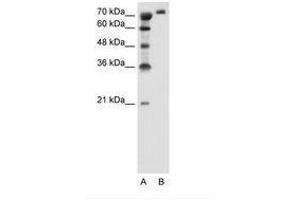 Image no. 2 for anti-Solute Carrier Family 6, Member 18 (SLC6A18) (AA 351-400) antibody (ABIN205030) (SLC6A18 Antikörper  (AA 351-400))