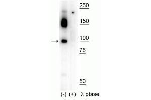Western blot of human T47D cell lysate showing specific immunolabeling of the ~100 kDa CtIP phosphorylated at Ser326 in the first lane (-). (Retinoblastoma Binding Protein 8 Antikörper  (pSer326))