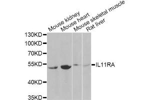 Western blot analysis of extracts of various cell lines, using IL11RA Antibody (ABIN2563389) at 1:1000 dilution. (IL11RA Antikörper)