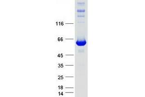 Western Blotting (WB) image for Inosine 5'-Phosphate Dehydrogenase 1 (IMPDH1) (Transcript Variant 2) protein (Myc-DYKDDDDK Tag) (ABIN2723434)