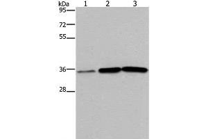 Western Blot analysis of Human testis tissue, A549 and PC3 cell using MAGEA3 Polyclonal Antibody at dilution of 1:400 (MAGEA3 Antikörper)