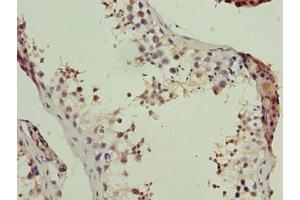 Immunohistochemistry of paraffin-embedded human testis tissue using ABIN7174200 at dilution of 1:100 (LSM7 Antikörper  (AA 2-103))