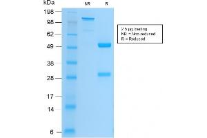 SDS-PAGE Analysis Purified CD61 Rabbit Recombinant Monoclonal Antibody (ITGB3/2166R). (Rekombinanter Integrin beta 3 Antikörper  (AA 385-490))