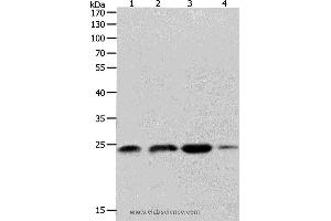 Western blot analysis of K562, 231 and Hela cell, Human fetal brain tissue, using RHOA Polyclonal Antibody at dilution of 1:400 (RHOA Antikörper)