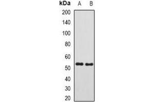 Western blot analysis of SUFU expression in mouse testis (A), rat kidney (B) whole cell lysates.