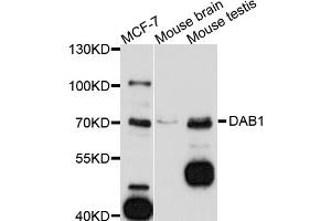 Western blot analysis of extracts of various cell lines, using DAB1 antibody (ABIN5997560) at 1/1000 dilution. (DAB1 Antikörper)