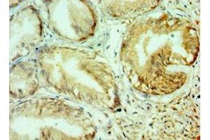 Immunohistochemistry of paraffin-embedded human prostate tissue using ABIN7148222 at dilution of 1:100 (COL1A1 Antikörper  (AA 521-680))