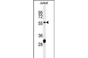 Western blot analysis of HADHB Antibody (C-term) (ABIN653816 and ABIN2843089) in Jurkat cell line lysates (35 μg/lane). (HADHB Antikörper  (C-Term))