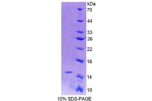 SDS-PAGE analysis of Rat OT Protein. (OXT Protein)