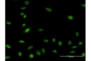Immunofluorescence of monoclonal antibody to OLIG2 on HeLa cell.