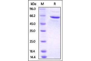SDS-PAGE (SDS) image for FK506 Binding Protein 4, 59kDa (FKBP4) (AA 1-459) protein (His tag,PA tag) (ABIN4949097)