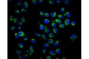 Immunofluorescence staining of Hela cells with ABIN7167342 at 1:166, counter-stained with DAPI. (RAB42 Antikörper  (AA 1-105))