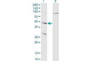 Western Blot analysis of CTSD expression in transfected 293T cell line by CTSD monoclonal antibody (M01), clone 3F12-1B9. (Cathepsin D Antikörper  (AA 26-412))