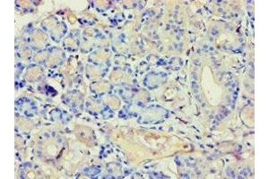 Immunohistochemistry of paraffin-embedded human pancreatic tissue using ABIN7144294 at dilution of 1:100 (Annexin VII Antikörper  (AA 259-488))