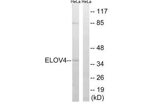 Western blot analysis of extracts from HeLa cells, using ELOVL4 antibody. (ELOVL4 Antikörper  (Internal Region))