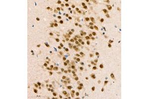 Immunohistochemistry of paraffin embedded mouse brain using COPS2 (ABIN7073324) at dilution of 1:1400 (400x lens) (CSN2 Antikörper)