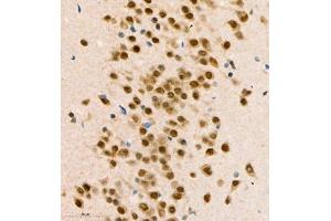 Immunohistochemistry of paraffin embedded mouse brain using COPS2 (ABIN7073324) at dilution of 1:1400 (400x lens)