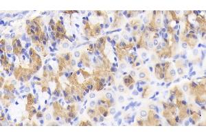 Immunohistochemistry (IHC) image for anti-Chemokine (C-C Motif) Ligand 2 (CCL2) (AA 24-99) antibody (ABIN7430900)