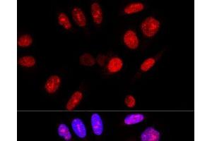 Confocal immunofluorescence analysis of U-2 OS cells using Ataxin 3 Polyclonal Antibody at dilution of 1:100. (Ataxin 3 Antikörper)