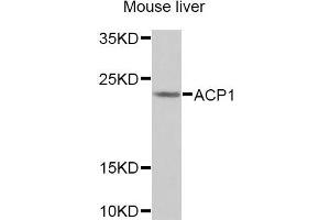 Western blot analysis of extracts of Mouse liver cells, using ACP1 antibody. (ACP1 Antikörper)