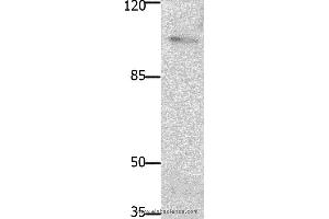 Western blot analysis of Mouse brain tissue, using PTK2 Polyclonal Antibody at dilution of 1:1850 (FAK Antikörper)