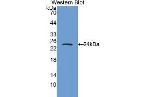 Western Blotting (WB) image for anti-Myosin Heavy Chain 6, Cardiac Muscle, alpha (MYH6) (AA 1747-1938) antibody (ABIN1859930) (MYH6 Antikörper  (AA 1747-1938))