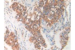 Figure. (PDXK Antikörper  (AA 29-253))