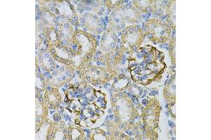 Immunohistochemistry of paraffin-embedded rat kidney using  Antibody (ABIN6127328, ABIN6136696, ABIN6136697 and ABIN6217467) at dilution of 1:100 (40x lens). (Adenylate Kinase 1 Antikörper  (AA 1-194))