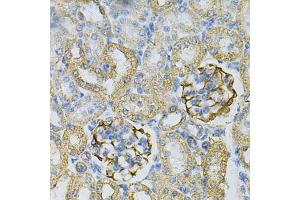 Immunohistochemistry of paraffin-embedded rat kidney using  Antibody (ABIN6127328, ABIN6136696, ABIN6136697 and ABIN6217467) at dilution of 1:100 (40x lens). (Adenylate Kinase 1 Antikörper  (AA 1-194))