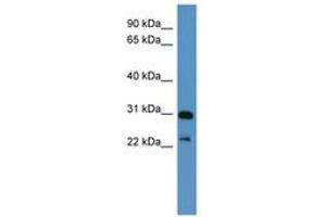 Image no. 1 for anti-Paired-Like Homeobox 2a (PHOX2A) (C-Term) antibody (ABIN6746154) (PHOX2A Antikörper  (C-Term))