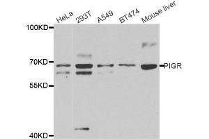 Western Blotting (WB) image for anti-Polymeric Immunoglobulin Receptor (PIGR) antibody (ABIN1877116) (PIGR Antikörper)