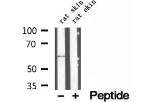 Western blot analysis of extracts of rat skin tissue, using P4HA1 antibody. (P4HA1 Antikörper  (N-Term))