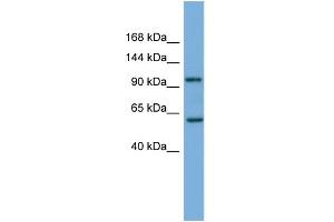 WB Suggested Anti-PI4KB Antibody Titration: 0. (PI4KB Antikörper  (Middle Region))