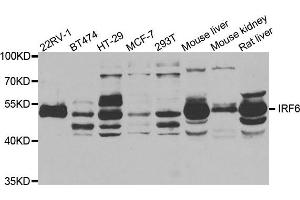 Western Blotting (WB) image for anti-Interferon Regulatory Factor 6 (IRF6) antibody (ABIN1882373)