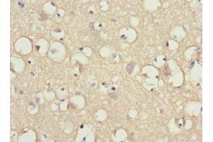 Immunohistochemistry of paraffin-embedded human brain tissue using ABIN7156711 at dilution of 1:100