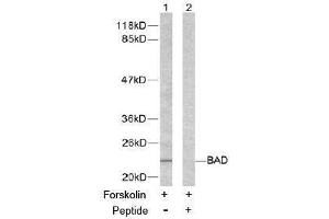 Image no. 2 for anti-BCL2-Associated Agonist of Cell Death (BAD) (Ser155) antibody (ABIN197213) (BAD Antikörper  (Ser155))