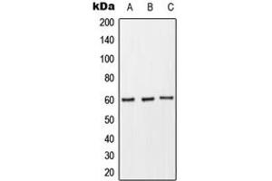 Western blot analysis of CD89 expression in THP1 (A), Raw264. (FCAR Antikörper  (Center))