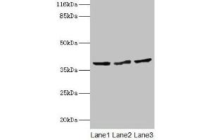 Western blot All lanes: CRYZL1 antibody at 12 μg/mL Lane 1: Hela whole cell lysate Lane 2: HepG2 whole cell lysate Lane 3: Jurkat whole cell lysate Secondary Goat polyclonal to rabbit IgG at 1/10000 dilution Predicted band size: 39, 22 kDa Observed band size: 39 kDa (CRYZL1 Antikörper  (AA 1-87))