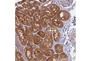 Immunohistochemical staining of human kidney with C10orf125 polyclonal antibody  shows strong cytoplasmic positivity in cells in tubules at 1:50-1:200 dilution. (FUOM Antikörper)