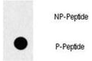 Dot blot analysis of p-EGFR antibody.