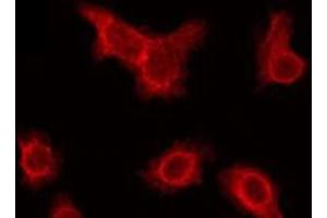 ABIN6275818 staining Hela by IF/ICC. (Cytochrome P450 2A6V2 Antikörper)