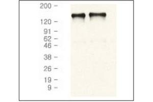 Western Blotting (WB) image for anti-Epidermal Growth Factor Receptor (EGFR) antibody (ABIN371623) (EGFR Antikörper)
