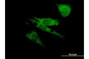 Immunofluorescence of monoclonal antibody to SCN8A on NIH/3T3 cell. (SCN8A Antikörper  (AA 1854-1951))