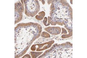 Immunohistochemical staining of human placenta with BGN polyclonal antibody  strong cytoplasmic positivity in trophoblastic cells. (Biglycan Antikörper)
