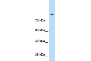 WB Suggested Anti-DLG2 Antibody Titration:  0. (DLG2 Antikörper  (N-Term))