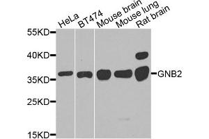 Western blot analysis of extracts of various cells, using GNB2 antibody. (GNB2 Antikörper)